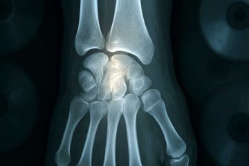 The X-Ray, a poem by Jenny Middleton at Spillwords.com